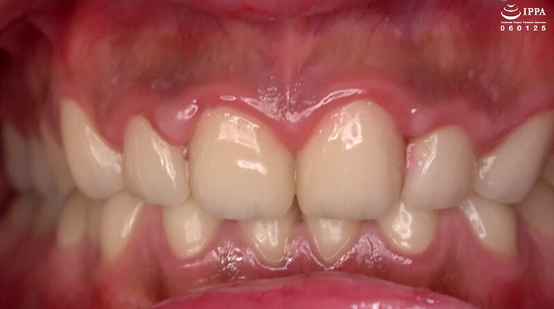 AD-01702 Part 8 - 30 minutes