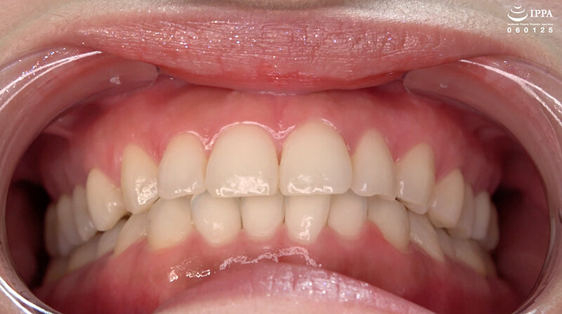 AD-01708 Bagian 4 - 30 minit