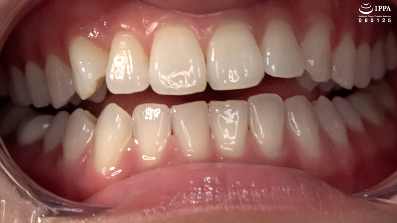 AD-01740 パート 6 - 30 分