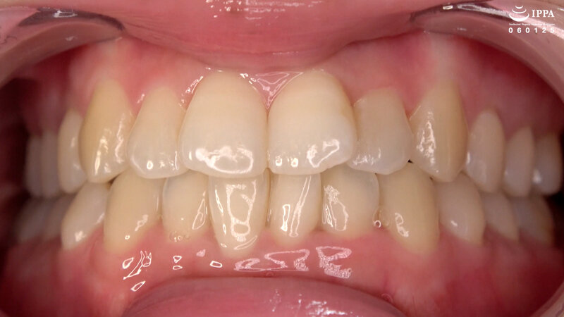 AD-01756 第 5 部分 - 30 分钟