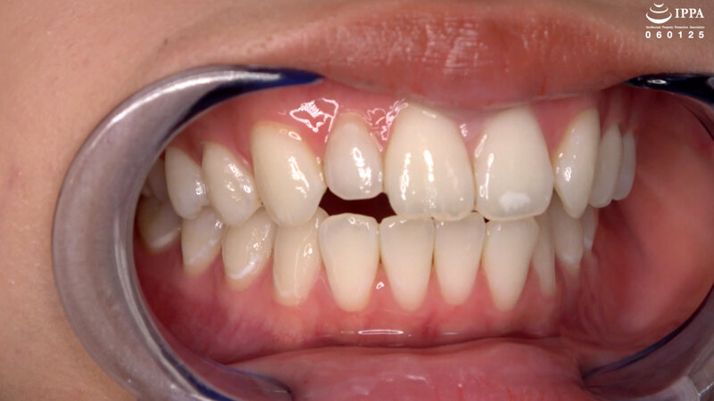 AD-01794 Bagian 11 - 40 minit