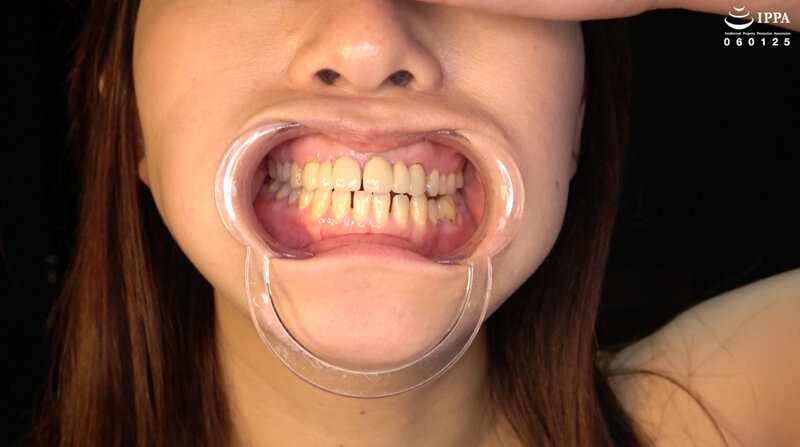 AD-01817 パート 2 - 30 分