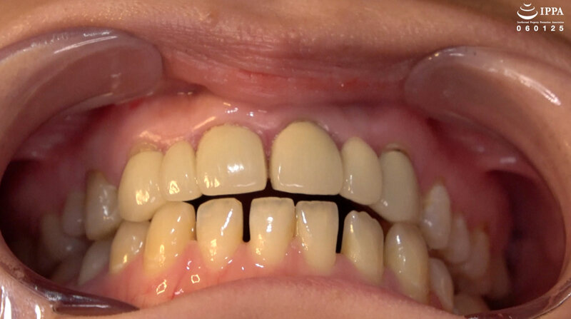 AD-01817 第 4 部分 - 30 分钟