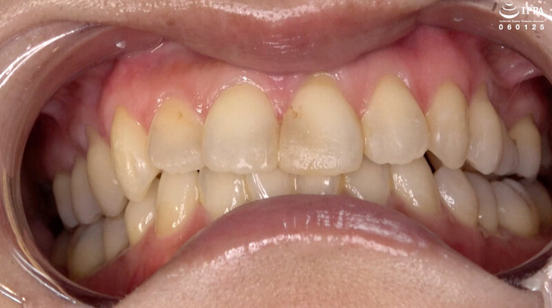 AD-01840 第 3 部分 - 30 分钟