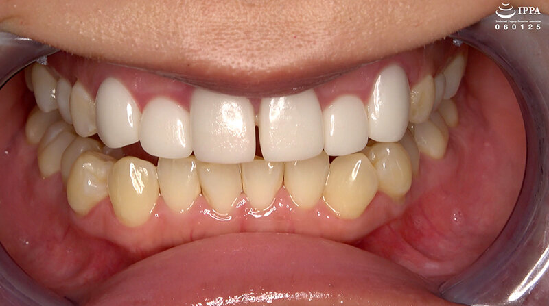 AD-01875 Bagian 3 - 30 minit