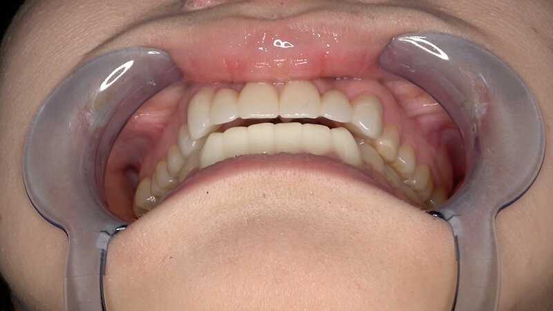 AD-01909 パート 5 - 30 分