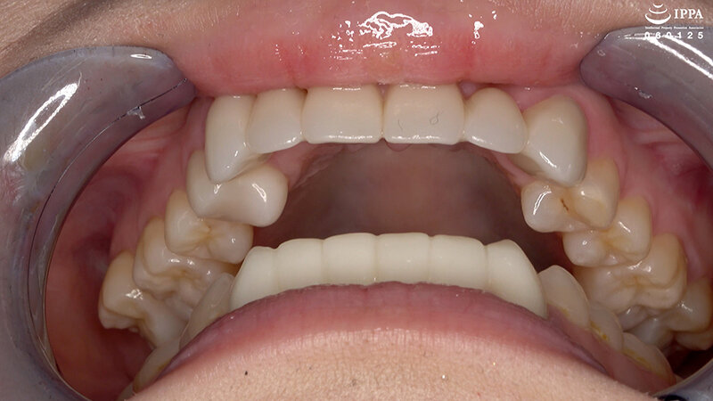 AD-01909 パート 6 - 30 分