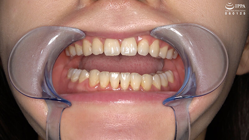 AD-01964 第 5 部分 - 34 分钟