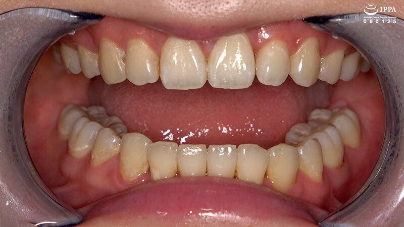 AD-01964 第 6 部分 - 35 分钟