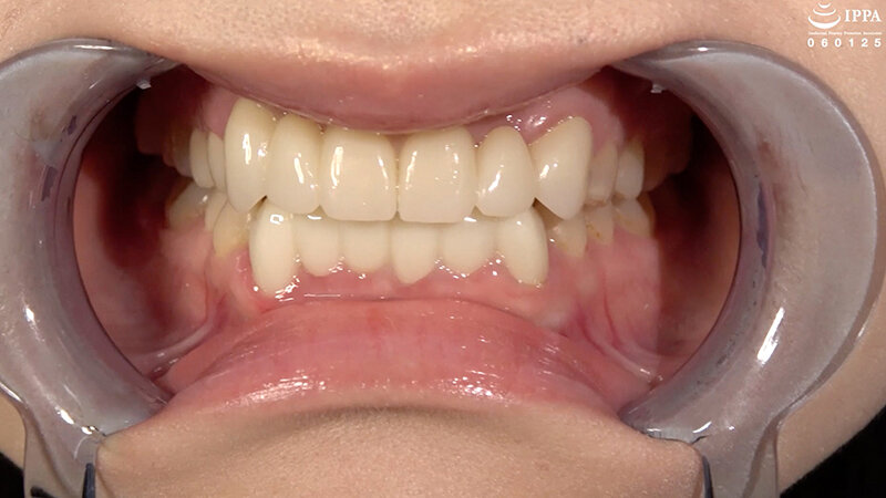 AD-01998 Bagian 2 - 31 minit