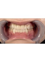 【歯・口腔フェチ】「超敏感女優 琥珀ややちゃんの口内観察＆巨大女フェチ」WAKA-077琥珀やや