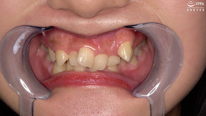 AD-02007 パート 2 - 31 分