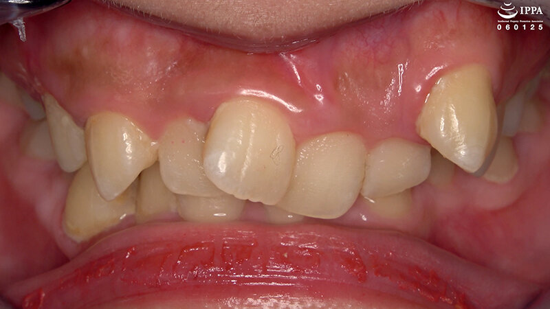 AD-02007 第 3 部分 - 32 分钟