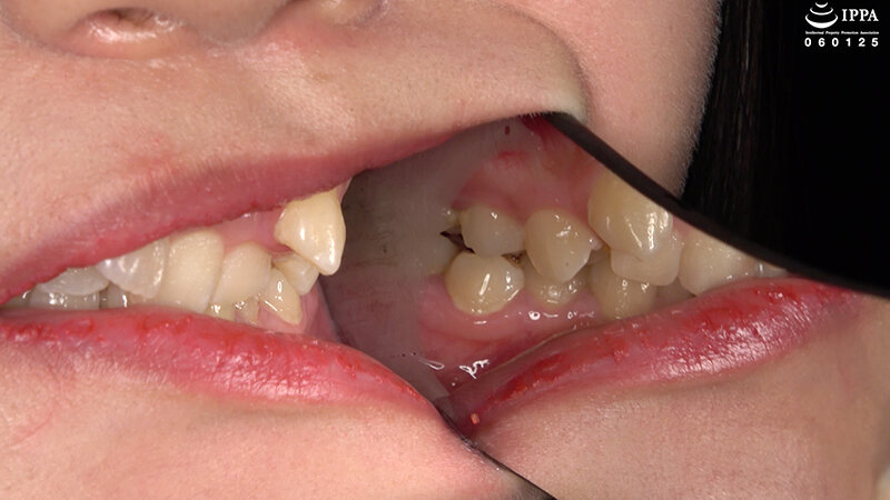 AD-02007 第 4 部分 - 33 分钟