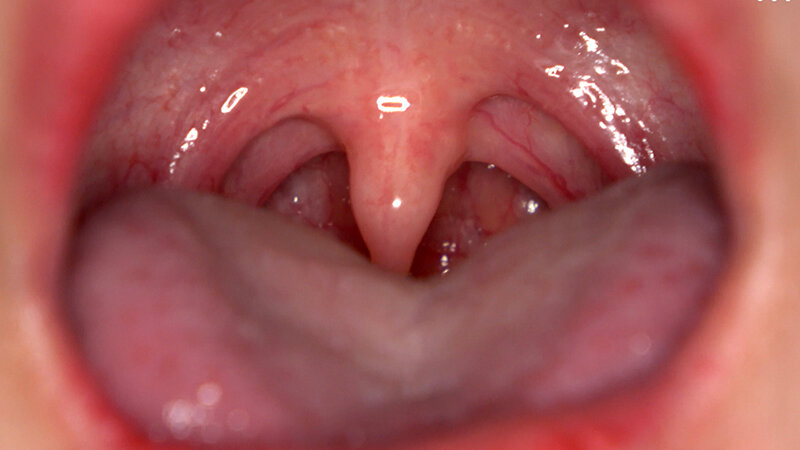 AD-02007 第 7 部分 - 36 分钟