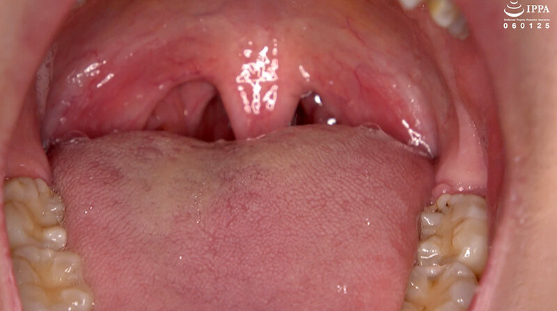 AD-02017 第 10 部分 - 30 分钟