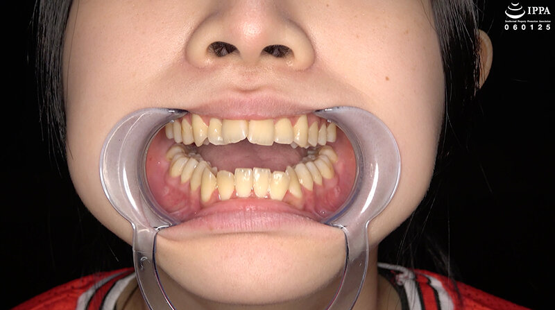 AD-02017 第 2 部分 - 30 分钟