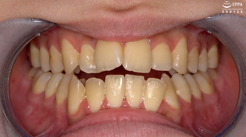 AD-02017 第 3 部分 - 30 分钟