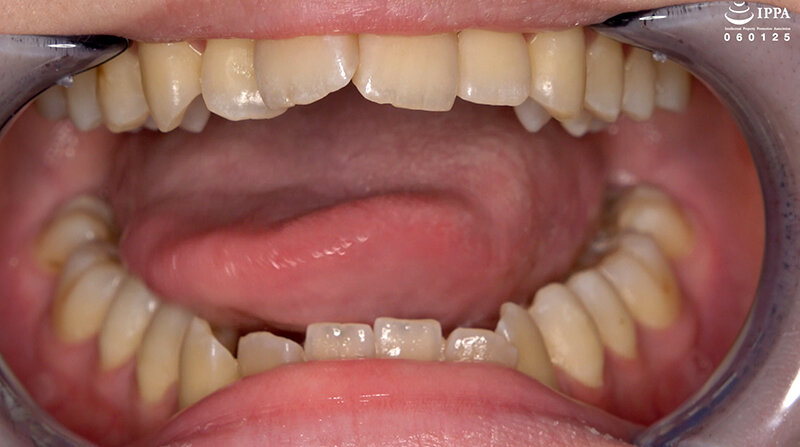 AD-02017 第 4 部分 - 30 分钟