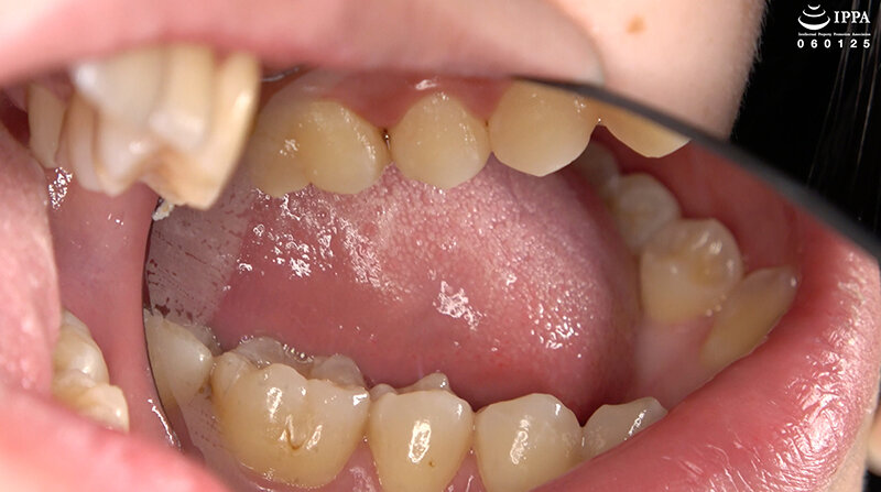 AD-02017 第 5 部分 - 30 分钟