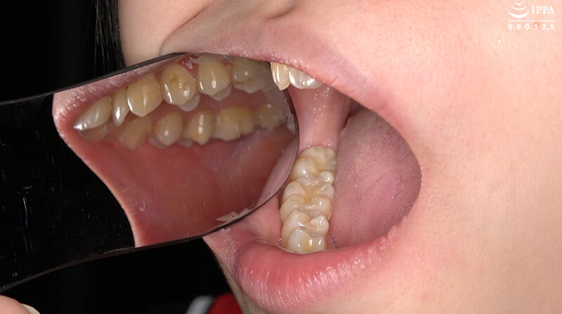 AD-02017 第 6 部分 - 30 分钟