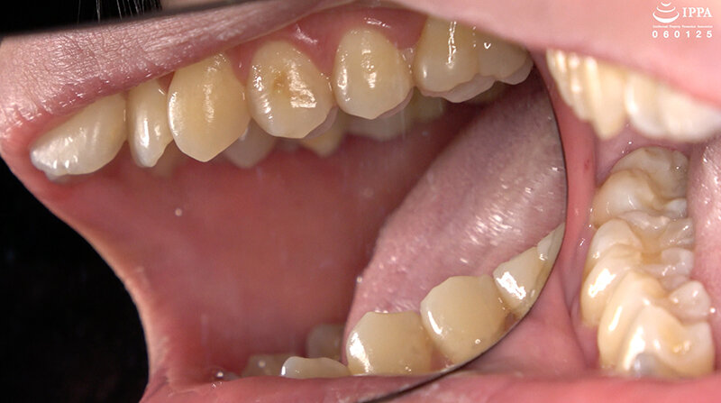 AD-02017 第 7 部分 - 30 分钟