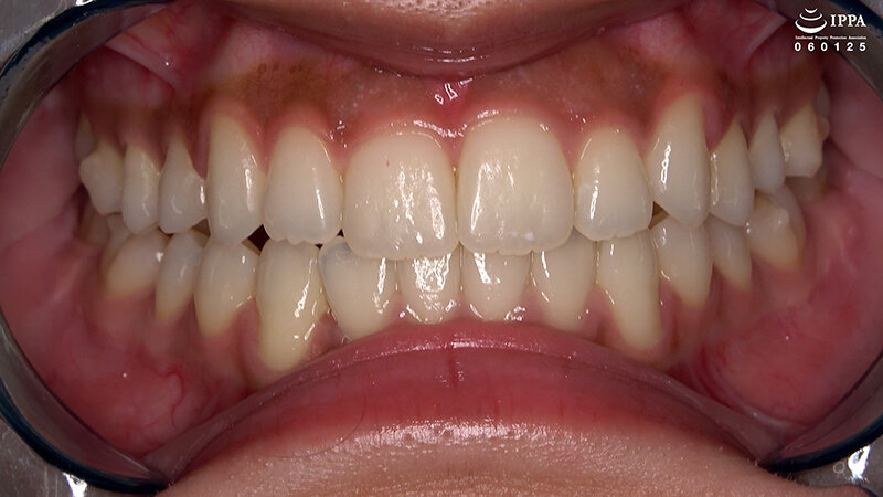 AD-02026 Part 3 - 30 minutes