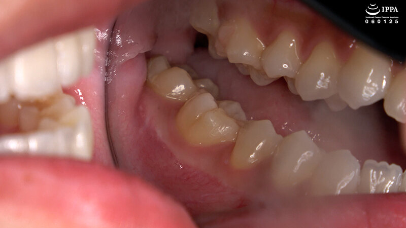 AD-02026 Part 4 - 30 minutes