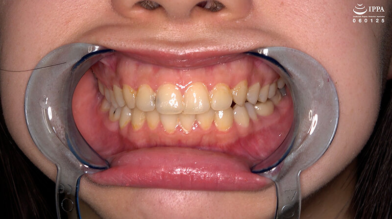 AD-02034 第 4 部分 - 30 分钟