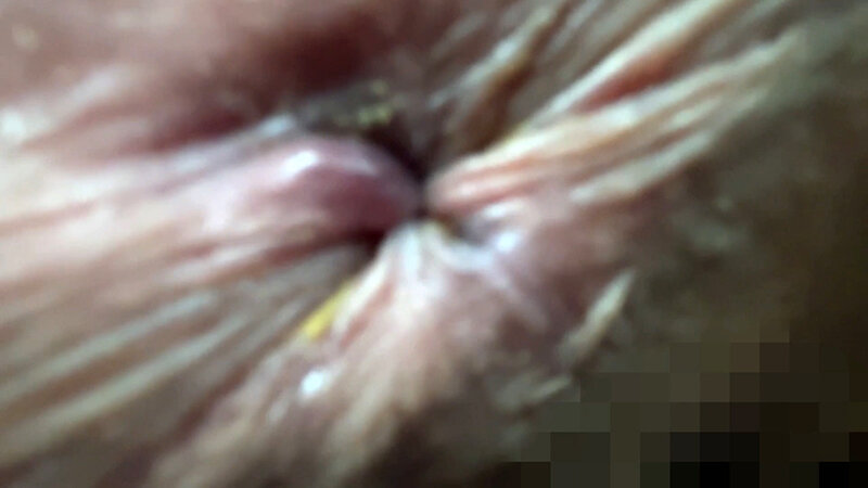 ANA-0300003 Part 14 - 30 minutes