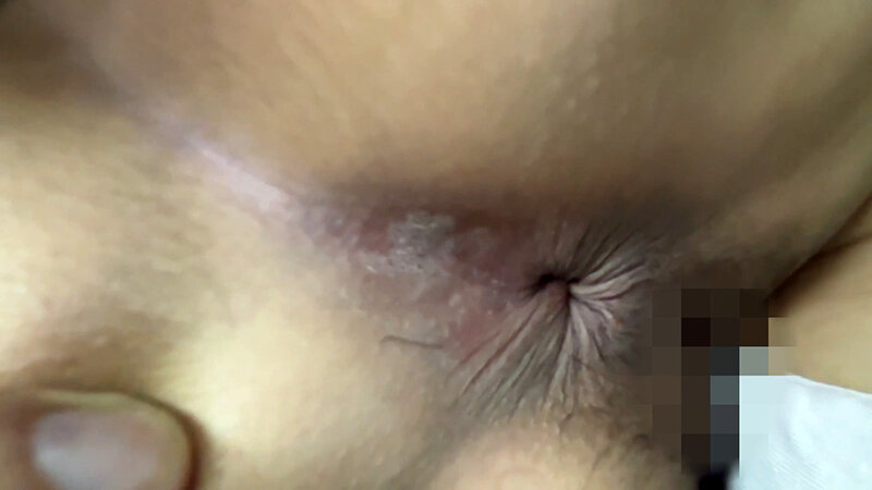 ANA-0300003 Bagian 15 - 30 minit