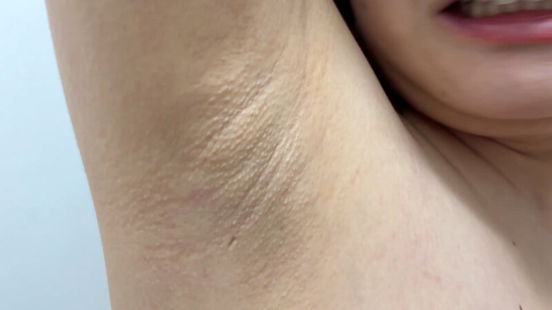 ESK-0500004 Bagian 20 - 30 minit