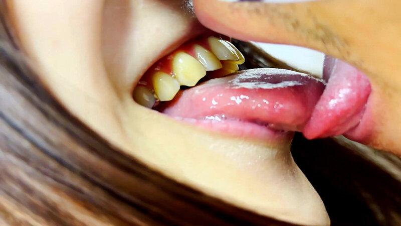 KIST-0100002 Part 18 - 30 minutes