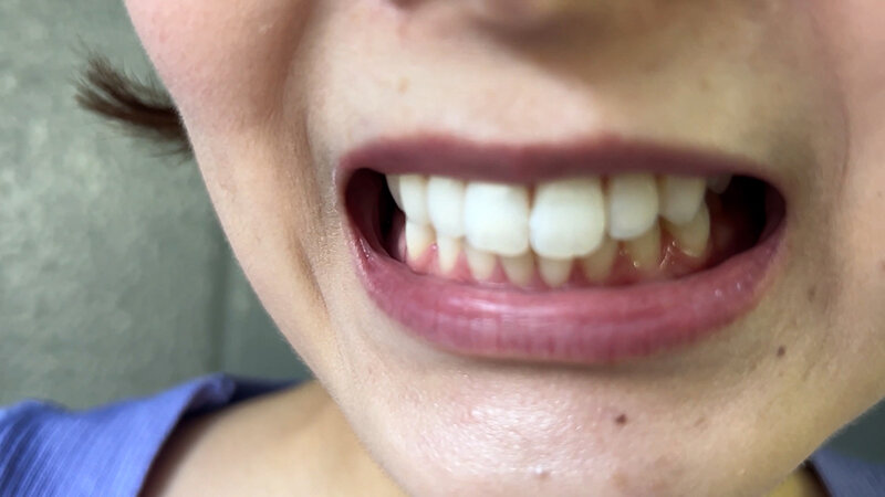 NKO-003 第 18 部分 - 64 分钟