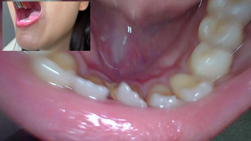 NKO-005 Bagian 11 - 50 minit