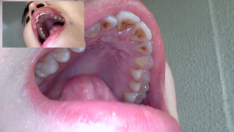 NKO-005 Bagian 12 - 52 minit