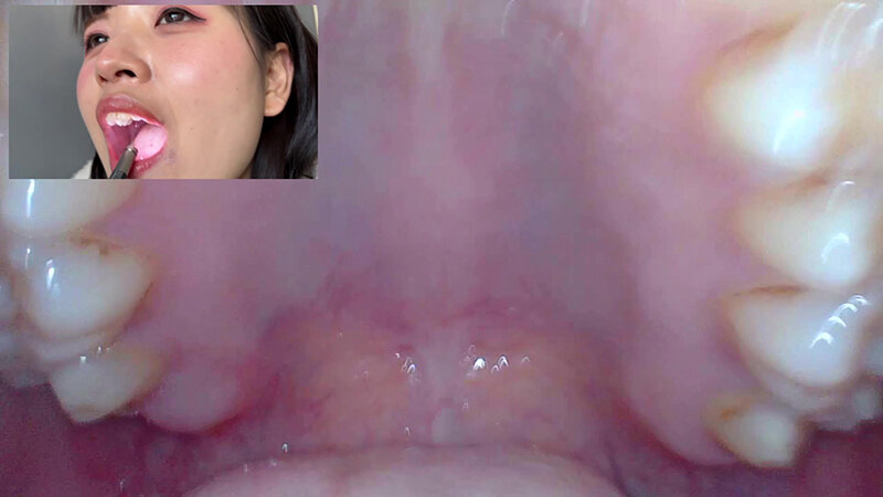 NKO-005 Bagian 9 - 46 minit