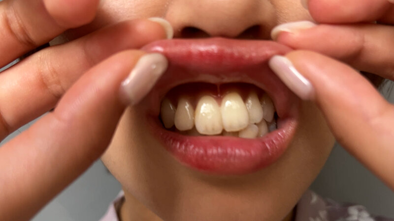 NKO-014 第 11 部分 - 30 分钟