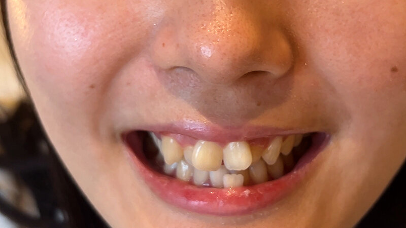 NKO-021 Part 17 - 46 minutes