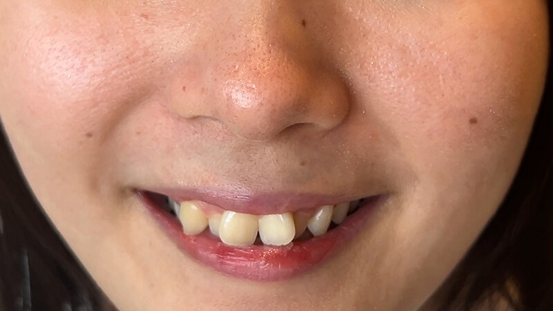 NKO-021 Part 3 - 32 minutes