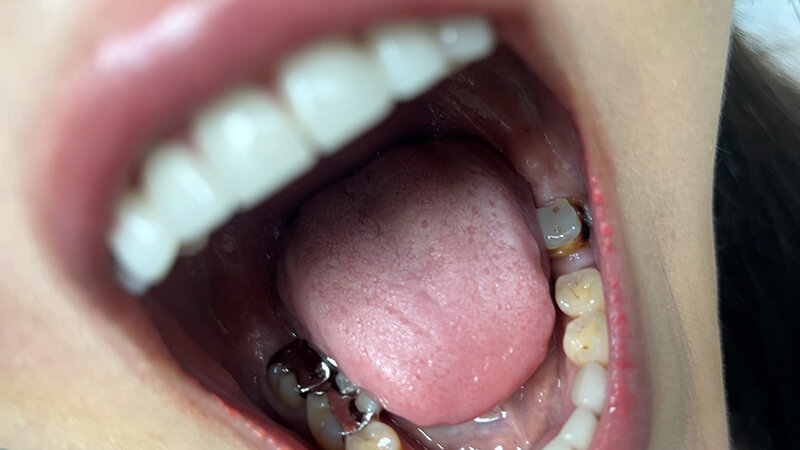 NKO-024 パート 7 - 30 分