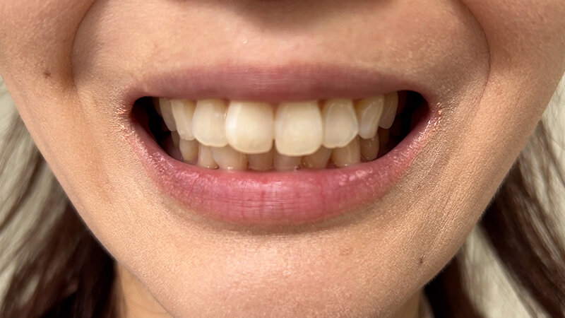 NKO-027 第 4 部分 - 30 分钟