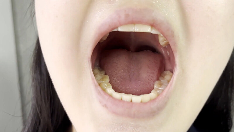 NKO-0300002 第 15 部分 - 30 分钟