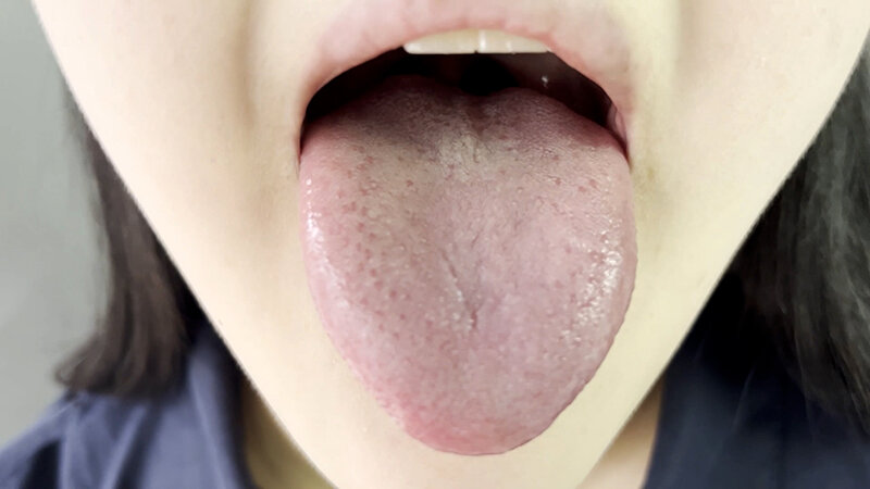 NKO-0300002 第 4 部分 - 30 分钟