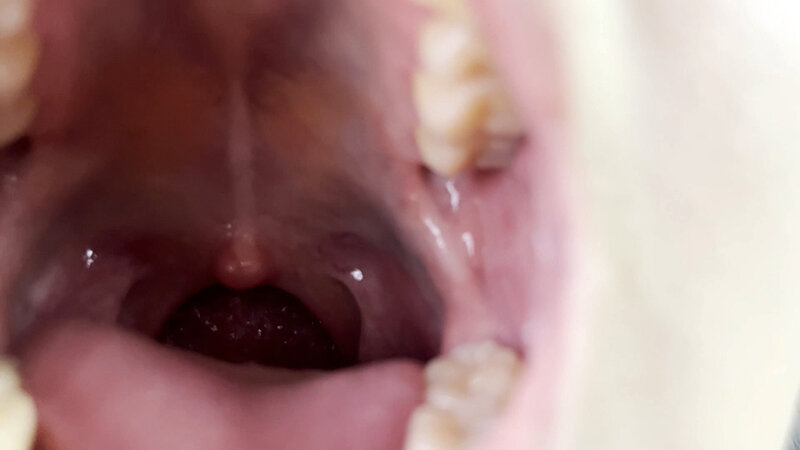 NKO-0300002 第 6 部分 - 30 分钟