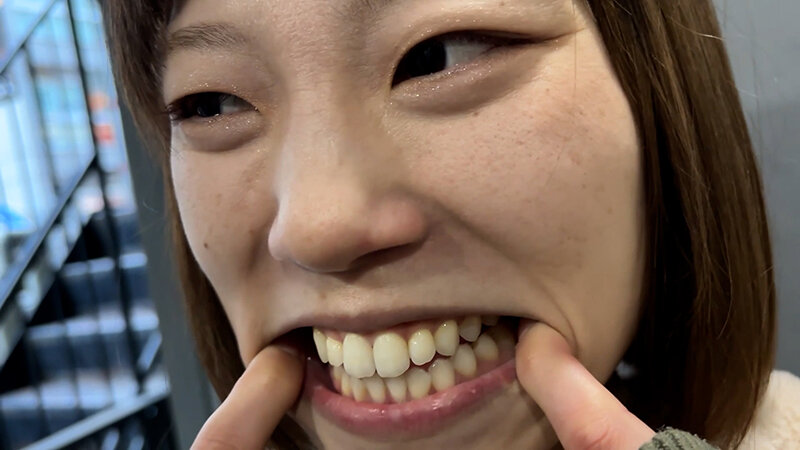 街角で声をかけて口内観察させてもらう オーガニックスーパー勤務 はつみちゃん 画像13