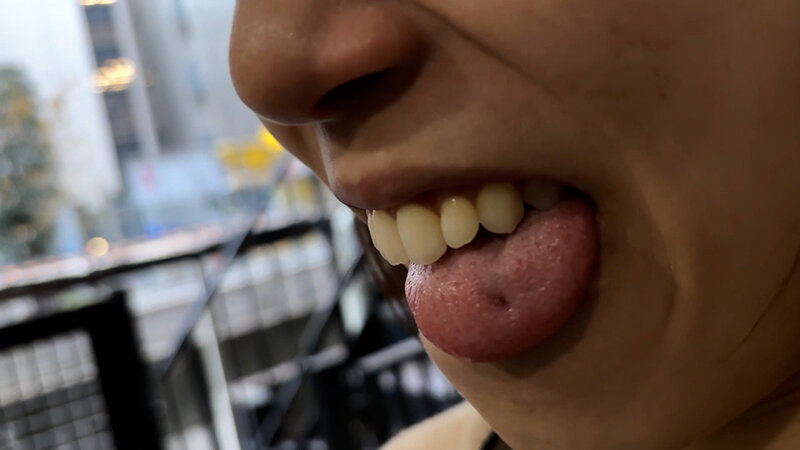 街角で声をかけて口内観察させてもらう オーガニックスーパー勤務 はつみちゃん 画像17
