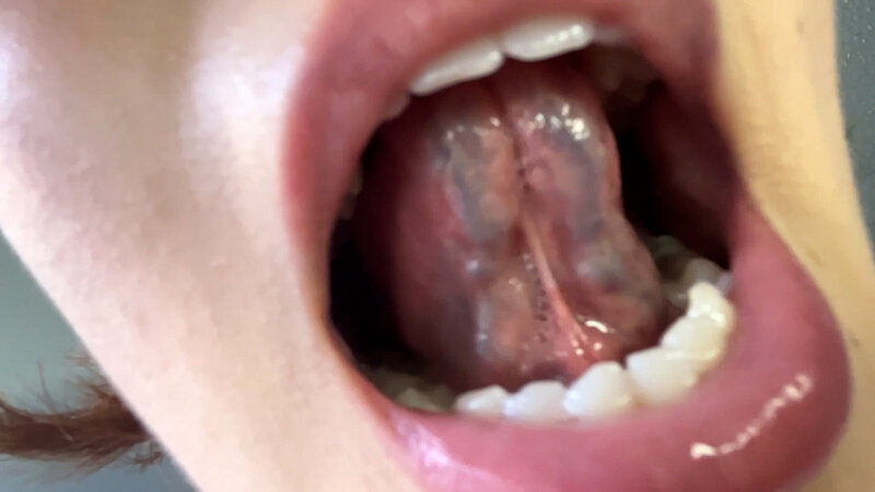 NKO-0300004 第 17 部分 - 30 分钟