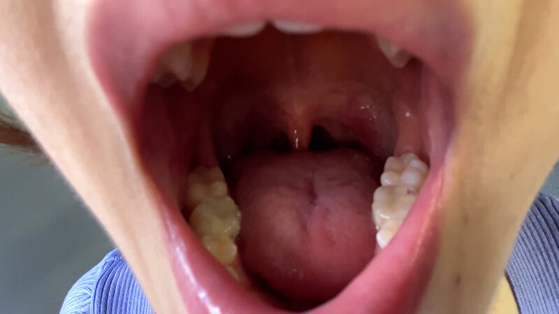 NKO-0300004 第 18 部分 - 30 分钟