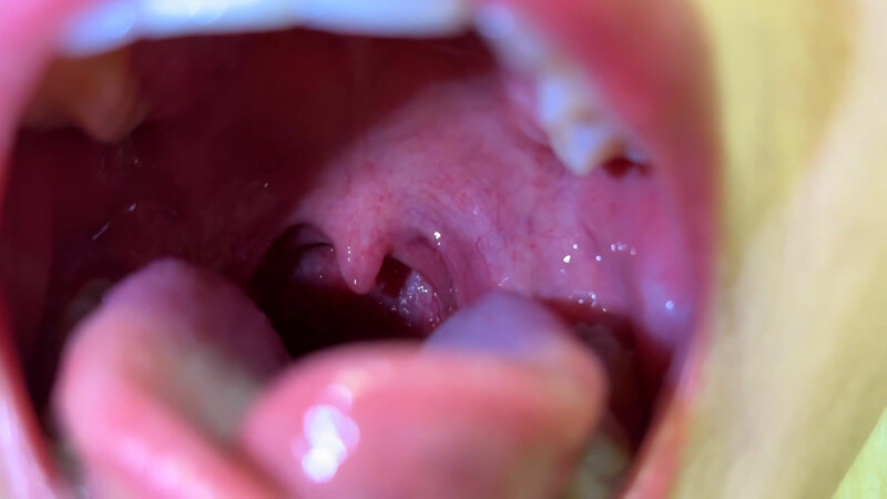 NKO-0500001 第 11 部分 - 30 分钟